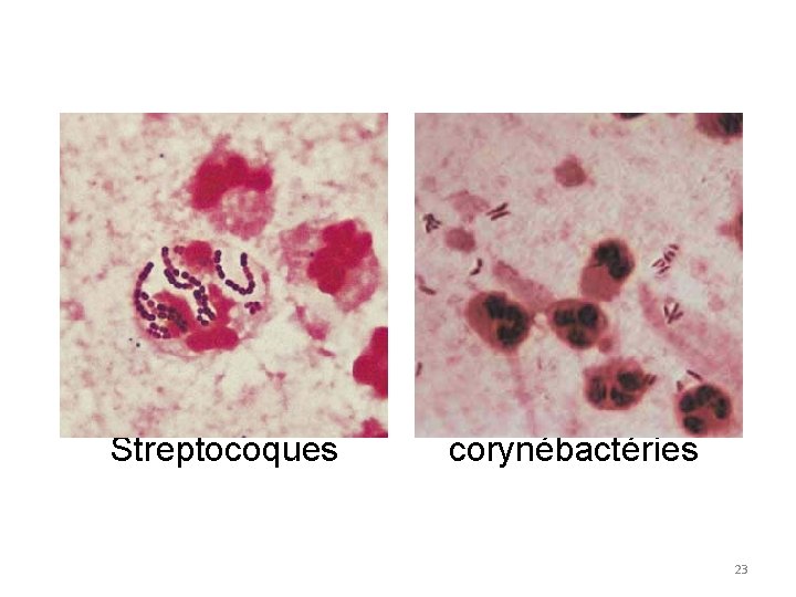 Streptocoques corynébactéries 23 