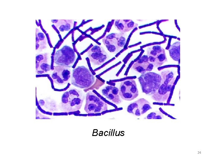 Bacillus 24 