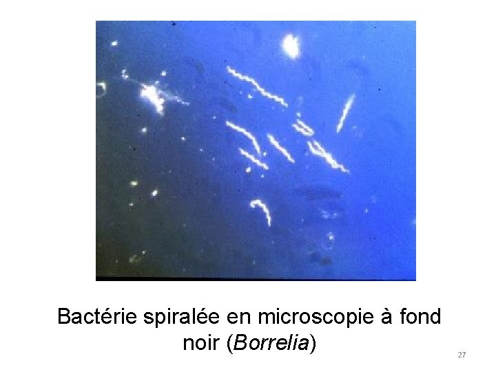 Bactérie spiralée en microscopie à fond noir (Borrelia) 27 