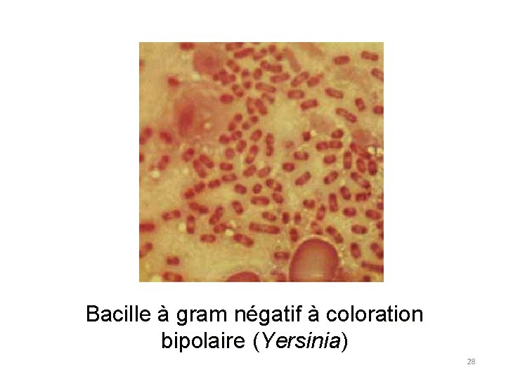 Bacille à gram négatif à coloration bipolaire (Yersinia) 28 