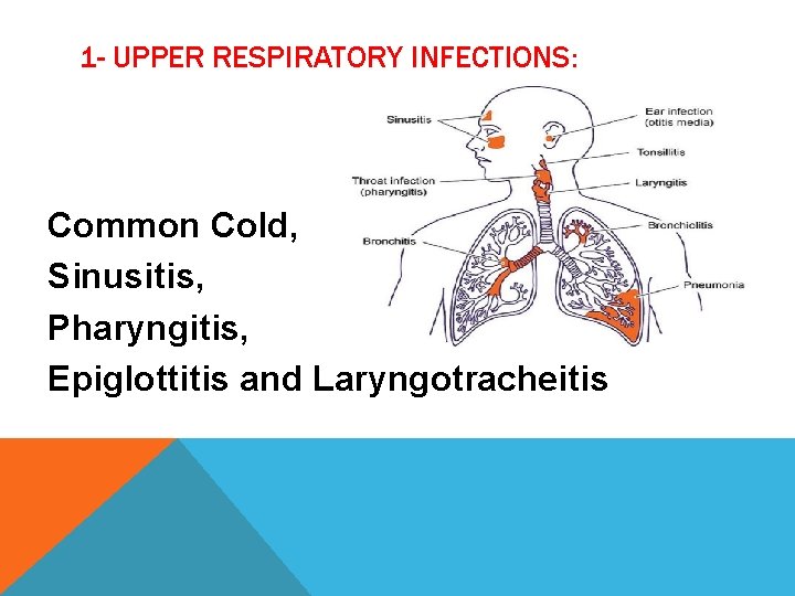 1 - UPPER RESPIRATORY INFECTIONS: Common Cold, Sinusitis, Pharyngitis, Epiglottitis and Laryngotracheitis 