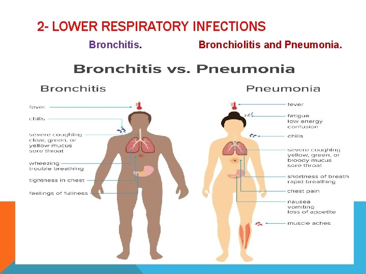 2 - LOWER RESPIRATORY INFECTIONS Bronchitis. Bronchiolitis and Pneumonia. 