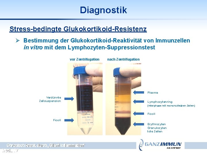 Diagnostik Stress-bedingte Glukokortikoid-Resistenz Ø Bestimmung der Glukokortikoid-Reaktivität von Immunzellen in vitro mit dem Lymphozyten-Suppressionstest