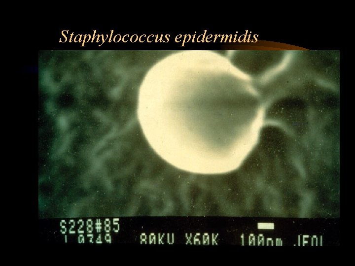 Staphylococcus epidermidis 