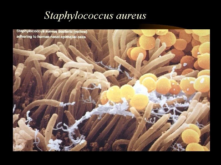 Staphylococcus aureus 