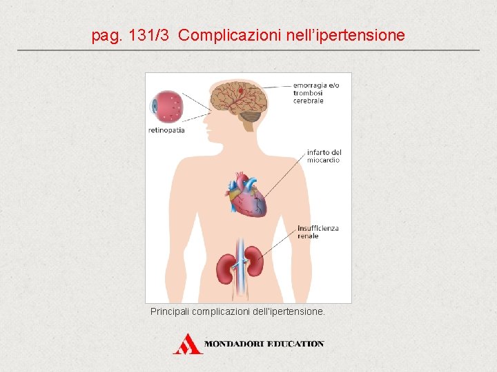 pag. 131/3 Complicazioni nell’ipertensione Principali complicazioni dell’ipertensione. 