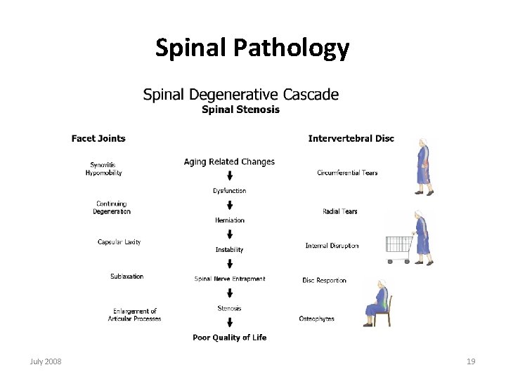 Spinal Pathology July 2008 19 