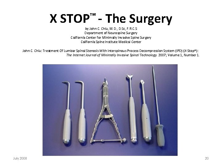 X STOP™ - The Surgery by John C. Chiu, M. D. , D. Sc,