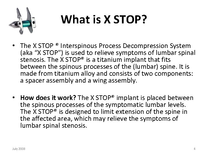 What is X STOP? • The X STOP ® Interspinous Process Decompression System (aka