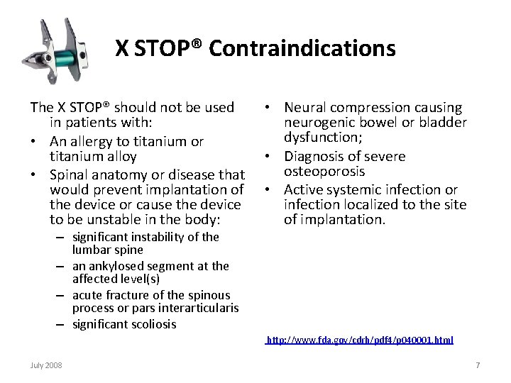X STOP® Contraindications The X STOP® should not be used in patients with: •
