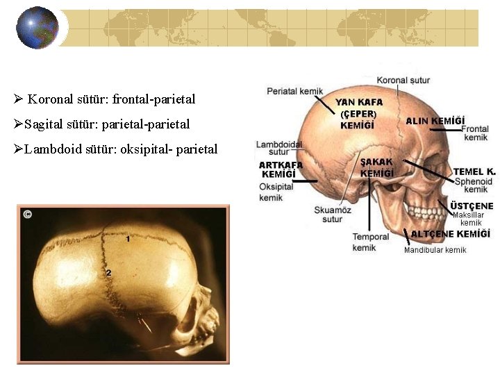 Ø Koronal sütür: frontal-parietal ØSagital sütür: parietal-parietal ØLambdoid sütür: oksipital- parietal 