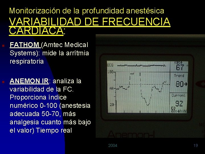 Monitorización de la profundidad anestésica VARIABILIDAD DE FRECUENCIA CARDÍACA: n n FATHOM (Amtec Medical