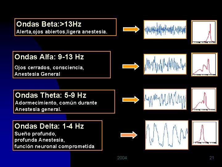 Ondas Beta: >13 Hz Alerta, ojos abiertos, ligera anestesia. Ondas Alfa: 9 -13 Hz