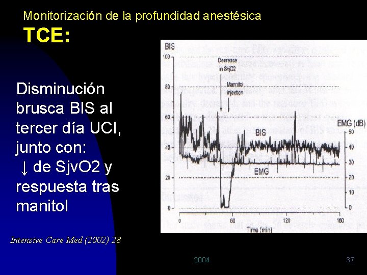 Monitorización de la profundidad anestésica TCE: Disminución brusca BIS al tercer día UCI, junto