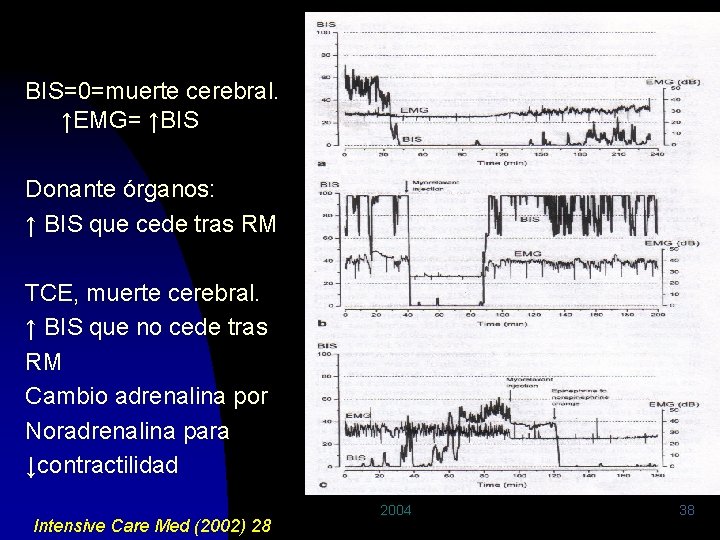 BIS=0=muerte cerebral. ↑EMG= ↑BIS Donante órganos: ↑ BIS que cede tras RM TCE, muerte