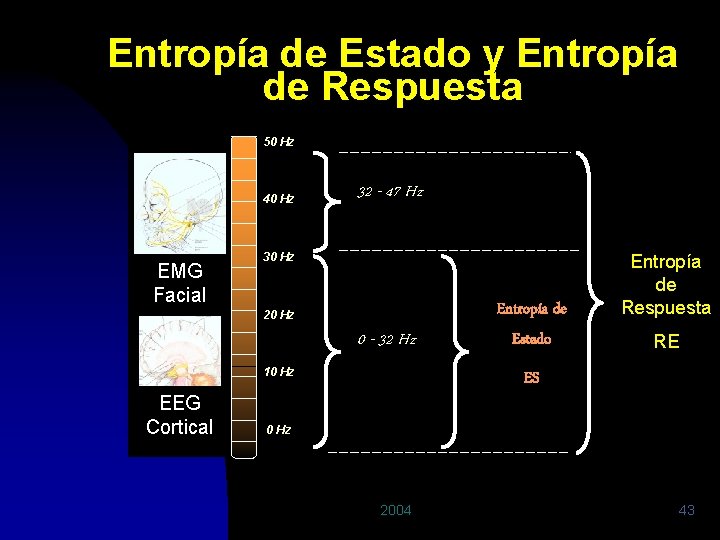 Entropía de Estado y Entropía de Respuesta High Frequency 50 Hz 40 Hz EMG