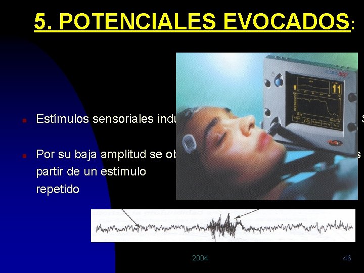 5. POTENCIALES EVOCADOS: n n Estímulos sensoriales inducen una respuesta eléctrica en el S