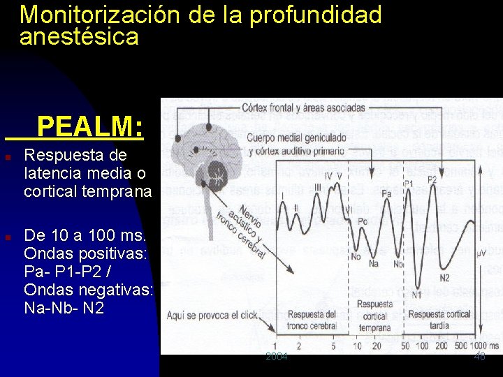 Monitorización de la profundidad anestésica PEALM: n n Respuesta de latencia media o cortical