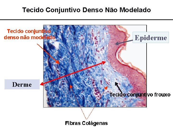 Tecido Conjuntivo Denso Não Modelado Epiderme Derme 