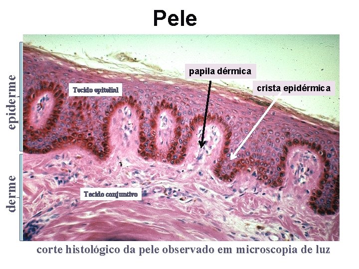 derme epiderme Pele papila dérmica Tecido epitelial crista epidérmica Tecido conjuntivo corte histológico da