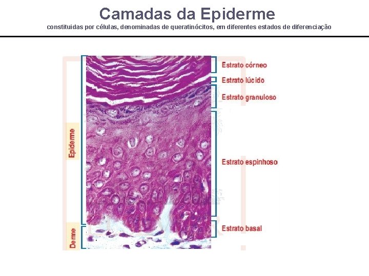Camadas da Epiderme constituidas por células, denominadas de queratinócitos, em diferentes estados de diferenciação