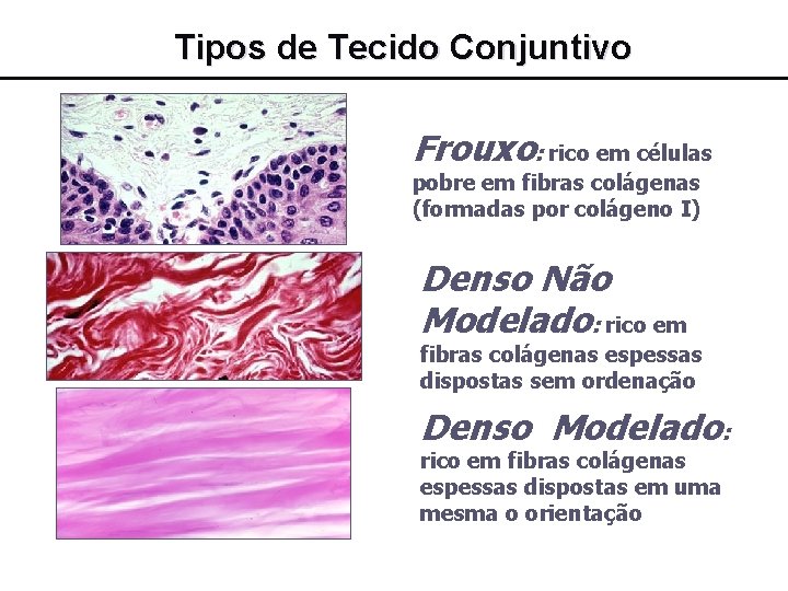 Tipos de Tecido Conjuntivo Frouxo: rico em células pobre em fibras colágenas (formadas por