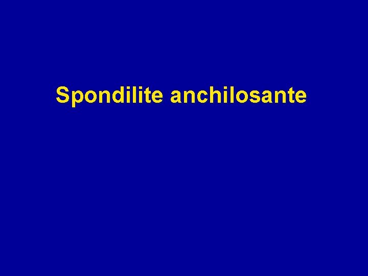 Spondilite anchilosante 