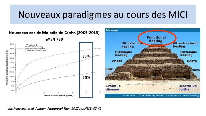 Nouveaux paradigmes au cours des MICI Nouveaux cas de Maladie de Crohn (2009 -2013)