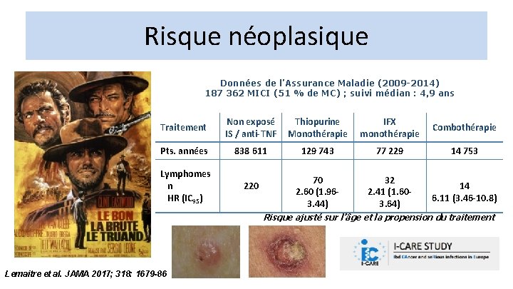 Risque néoplasique Données de l’Assurance Maladie (2009 -2014) 187 362 MICI (51 % de