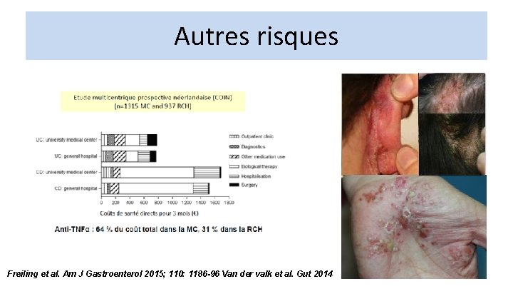 Autres risques Freiling et al. Am J Gastroenterol 2015; 110: 1186 -96 Van der