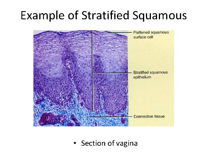 Example of Stratified Squamous • Section of vagina 