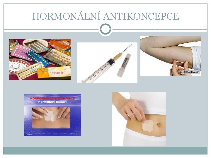 HORMONÁLNÍ ANTIKONCEPCE 