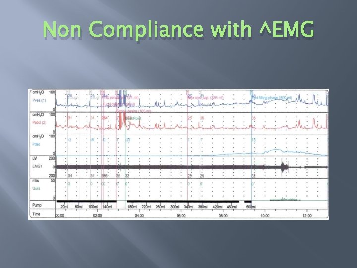 Non Compliance with ^EMG 