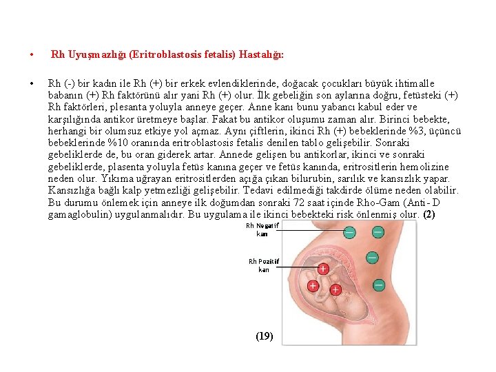  • Rh Uyuşmazlığı (Eritroblastosis fetalis) Hastalığı: • Rh (-) bir kadın ile Rh