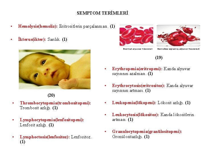 SEMPTOM TERİMLERİ • Hemolysis(hemoliz): Eritrositlerin parçalanması. (1) • İkterus(ikter): Sarılık. (1) (19) • Erythropenia(eritropeni):