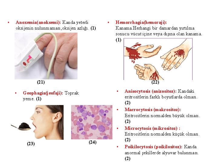  • Anoxemia(anoksemi): Kanda yeterli oksijenin nulunmaması, oksijen azlığı. (1) • Hemorrhagia(hemoraji): Kanama. Herhangi