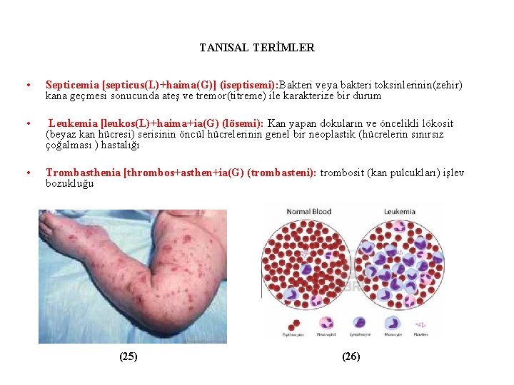 TANISAL TERİMLER • Septicemia [septicus(L)+haima(G)] (iseptisemi): Bakteri veya bakteri toksinlerinin(zehir) kana geçmesi sonucunda ateş