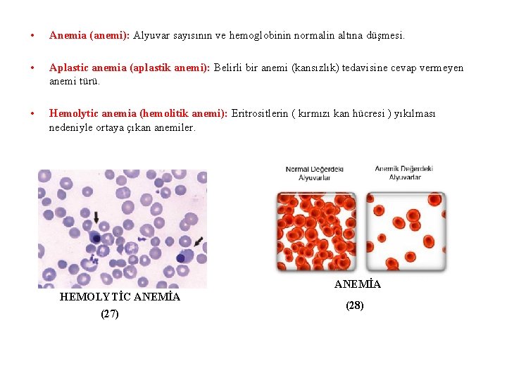  • Anemia (anemi): Alyuvar sayısının ve hemoglobinin normalin altına düşmesi. • Aplastic anemia