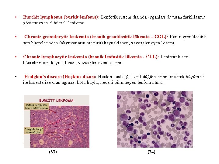  • Burchit lymphoma (burkit lenfoma): Lenfotik sistem dışında organları da tutan farklılaşma göstermeyen