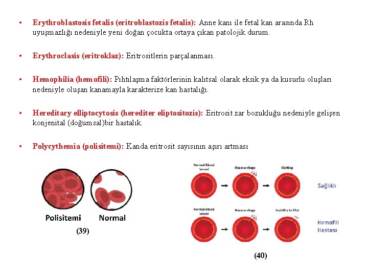  • Erythroblastosis fetalis (eritroblastozis fetalis): Anne kanı ile fetal kan arasında Rh uyuşmazlığı