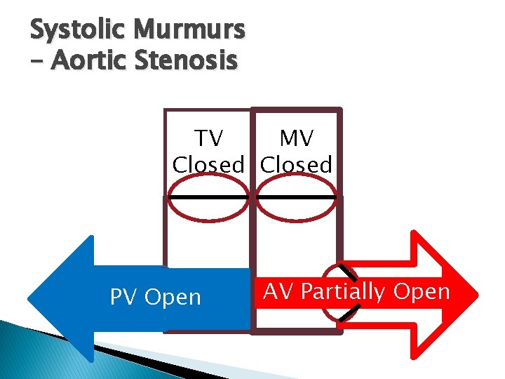 Systolic Murmurs – Aortic Stenosis TV MV Closed PV Open AV Partially Open Systolic Murmurs – Aortic Stenosis TV MV Closed PV Open AV Partially Open