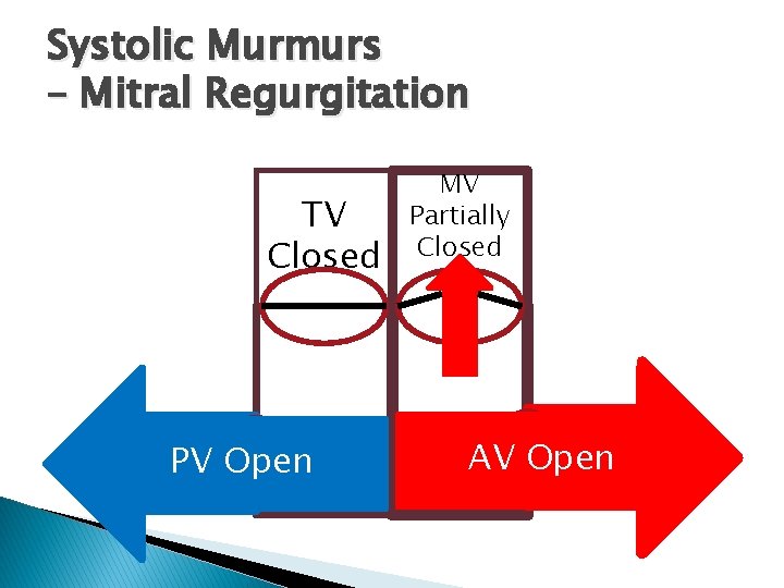 Systolic Murmurs – Mitral Regurgitation TV Closed PV Open MV Partially Closed AV Open Systolic Murmurs – Mitral Regurgitation TV Closed PV Open MV Partially Closed AV Open