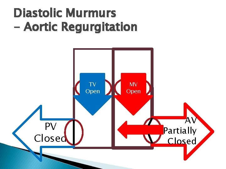 Diastolic Murmurs - Aortic Regurgitation TV Open PV Closed MV Open AV Partially Closed Diastolic Murmurs - Aortic Regurgitation TV Open PV Closed MV Open AV Partially Closed