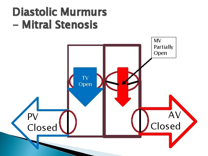 Diastolic Murmurs - Mitral Stenosis MV Partially Open TV Open PV Closed AV Closed Diastolic Murmurs - Mitral Stenosis MV Partially Open TV Open PV Closed AV Closed