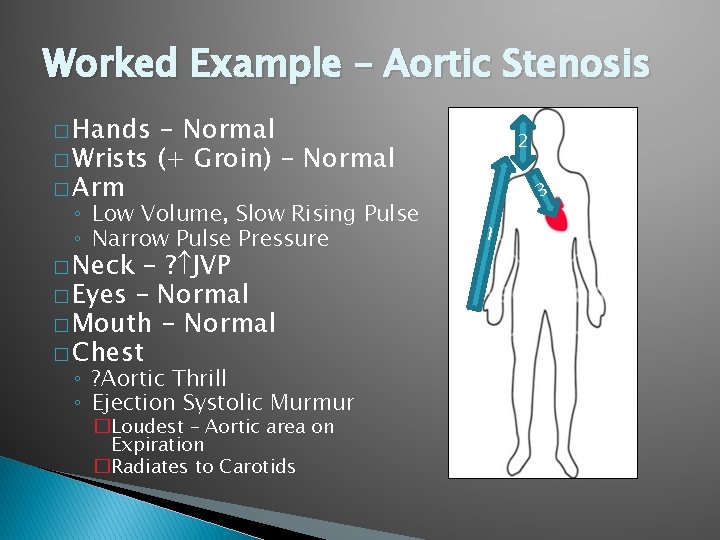 Worked Example – Aortic Stenosis � Hands - Normal � Wrists (+ Groin) - Worked Example – Aortic Stenosis � Hands - Normal � Wrists (+ Groin) -