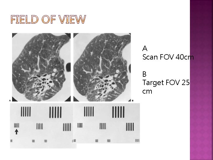 A Scan FOV 40 cm B Target FOV 25 cm 