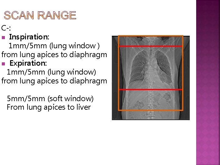 C-: n Inspiration: 1 mm/5 mm (lung window ) from lung apices to diaphragm
