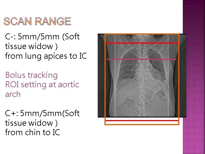 C-: 5 mm/5 mm (Soft tissue widow ) from lung apices to IC Bolus