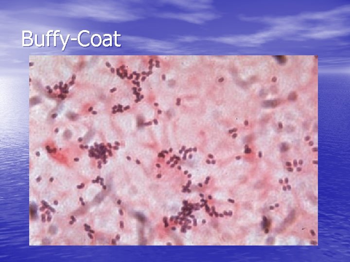 Buffy-Coat 