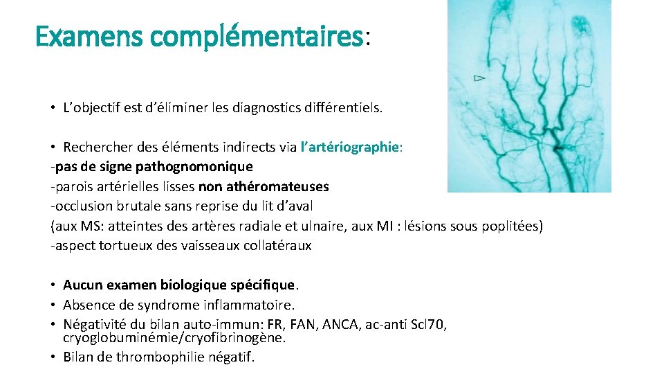 Examens complémentaires: • L’objectif est d’éliminer les diagnostics différentiels. • Recher des éléments indirects